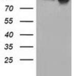 CTNNB1 monoclonal antibody