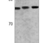 STAT3 Rabbit monoclonal antibody