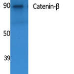 Catenin-beta Polyclonal Antibody
