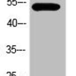 Phospho-TP53 (Ser366) Antibody