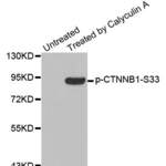 Anti Phospho CTNNB1 S33 Antibody