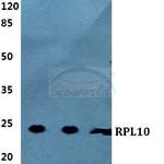 RPL10 polyclonal antibody