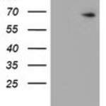 ESR1 (Estrogen Receptor 1/ER) monoclonal antibody