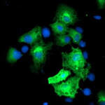 Monoacylglycerol Lipase Monoclonal Antibody (OTI1B1)