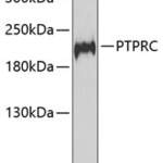 PTPRC polyclonal antibody