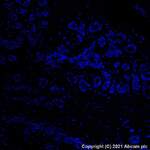 Recombinant Alexa Fluor® 488 Anti-ErbB2 / HER2 antibody [EP1045Y] (ab275994)
