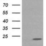 RAB30 monoclonal antibody