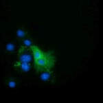 EPHX2 Monoclonal Antibody (OTI1A6)