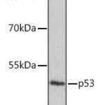 TP53 antibody #38624