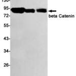 Recombinant beta Catenin Monoclonal Antibody