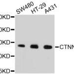 CTNNB1 Monoclonal Antibody
