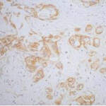CTNNB1 Monoclonal Antibody