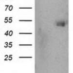 SHPK (CARKL) monoclonal antibody