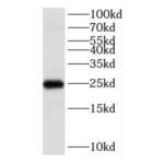 v Channel Interacting Protein 1 (KCNIP1) Antibody