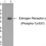 Phospho-ESR1 (Tyr537) Antibody