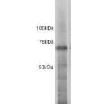 ESR1 Rabbit Polyclonal Antibody (0803-1)