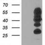 PTPN1 (PTP1B) monoclonal antibody