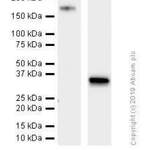 Recombinant Anti-ErbB2 / HER2 antibody [SP101] - BSA and Azide free (ab240410)