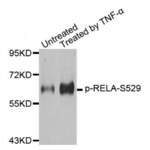 RELA (pS529) Antibody