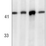 EIF2S1 (Phospho-S51) Rabbit monoclonal antibody