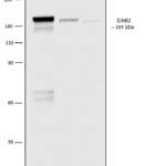 ErbB2 (HER-2) Monoclonal Antibody (e2-4001)