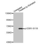 ESR1 (pS118) Antibody