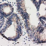 RASD2 Monoclonal Antibody (OTI1G1)