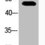 Acetyl-TP53 (K373) Antibody