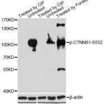 Anti Phospho CTNNB1 S552 Antibody