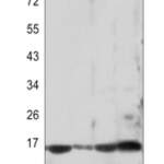 p16 ARC Rabbit monoclonal antibody