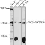 TNFRSF1B polyclonal antibody