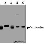 Vimentin (phospho-S56) polyclonal antibody
