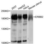 ErbB2 Polyclonal Antibody