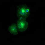 LMAN1 Monoclonal Antibody (OTI2B10), TrueMAB™
