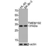 TMEM192 Recombinant Rabbit Monoclonal Antibody [JE64-89] (HA721106)