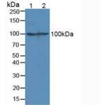 Catenin Beta 1 (CTNNb1) Antibody