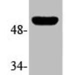 Phospho-TP53 (S315) Antibody