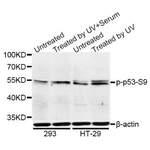 TP53 (pS9) Antibody