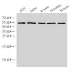 TP53 Polyclonal Antibody