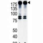 ErbB2 Antibody (F50600)