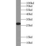 Thioredoxin Domain-Containing Protein 9 (TXNDC9) Antibody