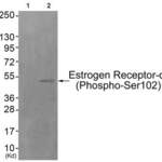 Phospho-ESR1 (Ser102) Antibody