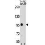 Catenin Beta 1 (CTNNB1) Antibody