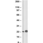 CD3e Antibody (R35652)