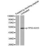TP53 (pS315) Antibody