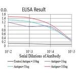 Estrogen Receptor Alpha (ESR1) Antibody