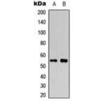 RUNX1 (pS276) Antibody