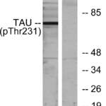 Tau (phospho Thr231) Polyclonal Antibody