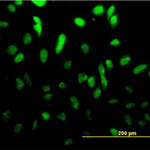 TCF4 Antibody (monoclonal) (M01)