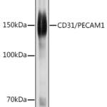 PECAM1 antibody #38622